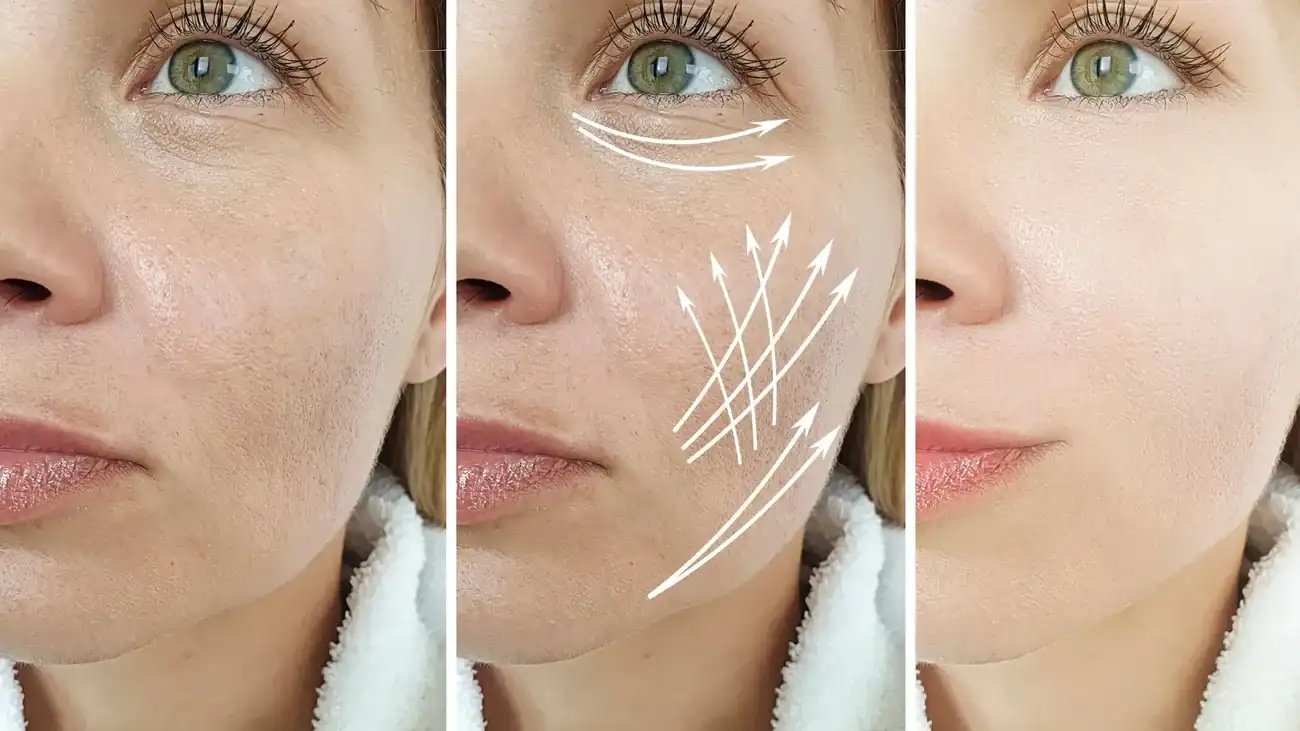 Can One Treatment Really Tackle More Than One Skin Concern Chesham?