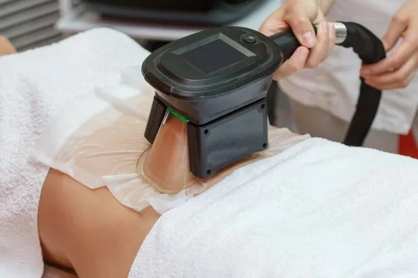 Image of person having fat freezing treatment to help weight gain Chesham