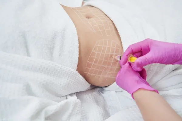 image of fat dissolving injections on love handles to help combat weight gain Chesham