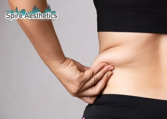 Image of woman pinching fat on their hips Chesham. Fat Freezing treatment