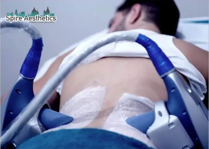 Man having fat freezing treatment done on love handles before a competitions Chesham to create a sculpted look.