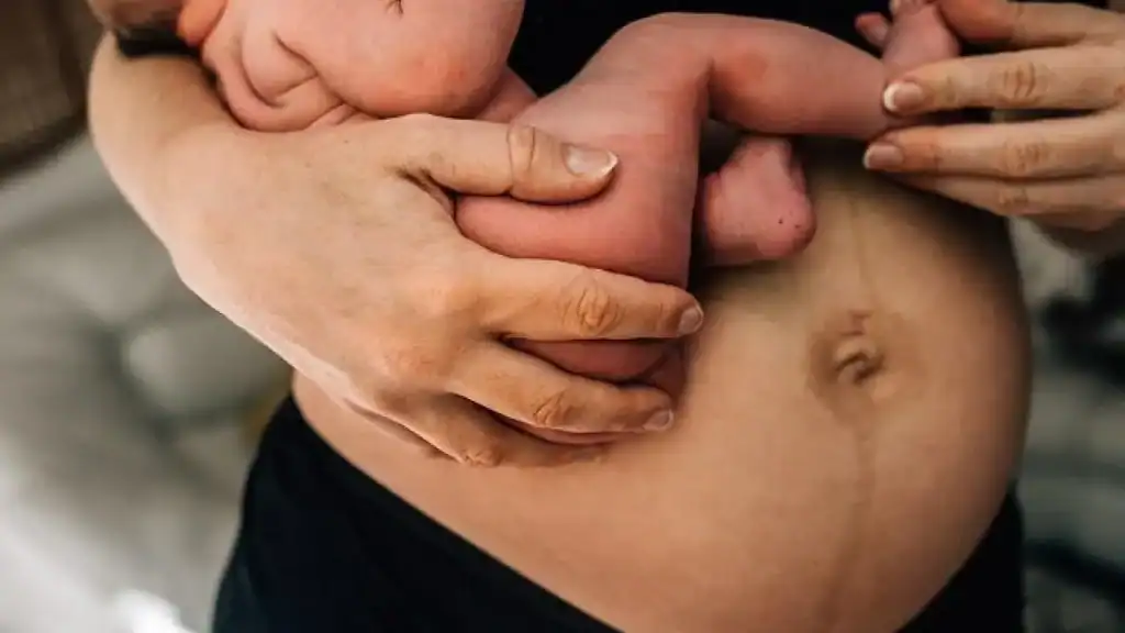 Why Is My Stomach Still Big After Pregnancy Chesham?