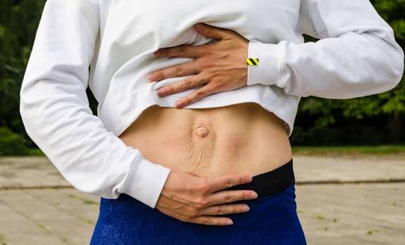 When Could Diastasis Recti Be the Missing Piece of the Puzzle Chesham?